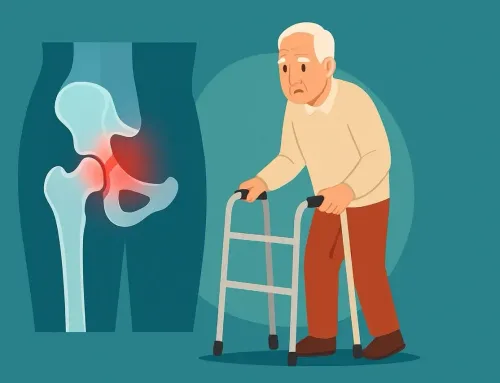 Understanding & Preventing Hip Fractures in Seniors